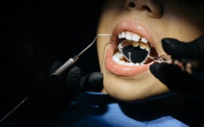 When Should Your Child Start Seeing the Dentist?