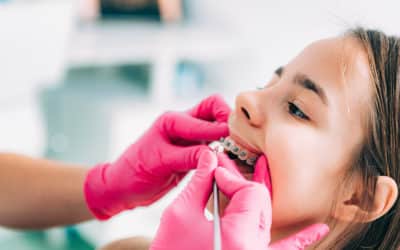 Nicholasville Children’s Dentist: How to Keep Kids Calm at the Dentist