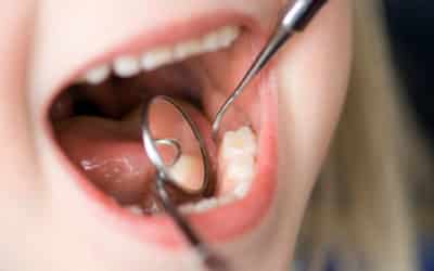 Dental Anxiety: How a Nicholasville Pediatric Dentist Can Help